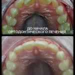 Работа ортодонта Головановой Д Б