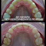 Работа ортодонта Головановой Д Б